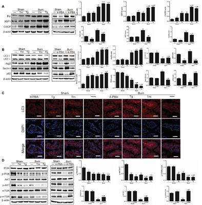 Role of Endoplasmic Reticulum Stress-Autophagy Axis in Severe Burn-Induced Intestinal Tight Junction Barrier Dysfunction in Mice